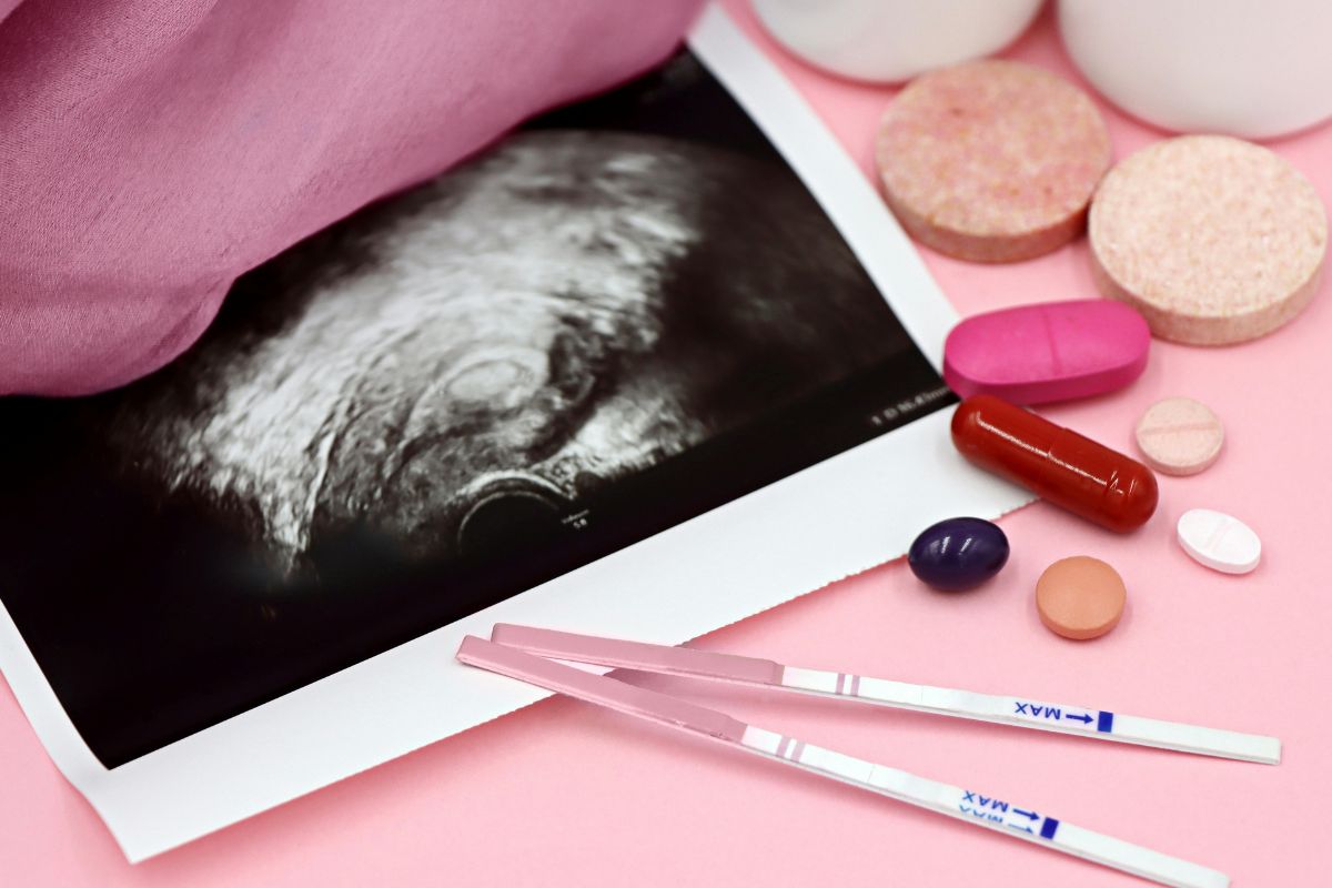 Ultrasound photo placed beside pregnancy test kits and vitamins.
